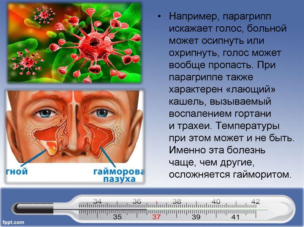 Хрипит голос. Парагрипп презентация. Парагрипп клинические проявления. Кашель при парагриппе. Лающий кашель при парагриппе.