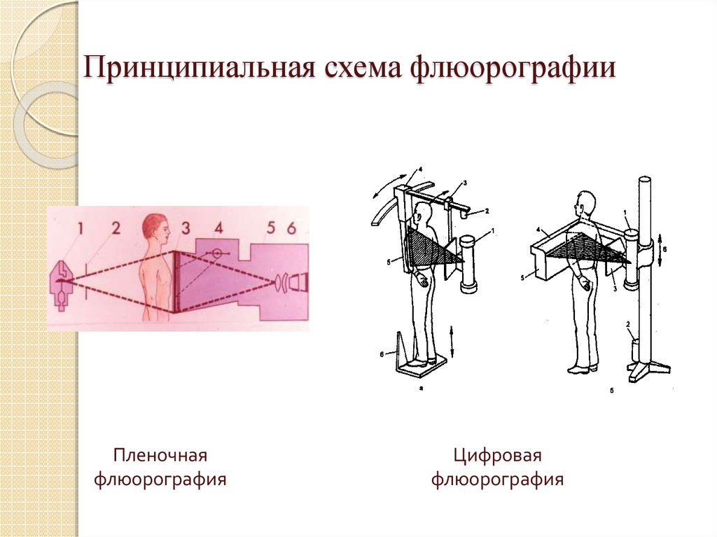 Аппарат для флюорографии фото