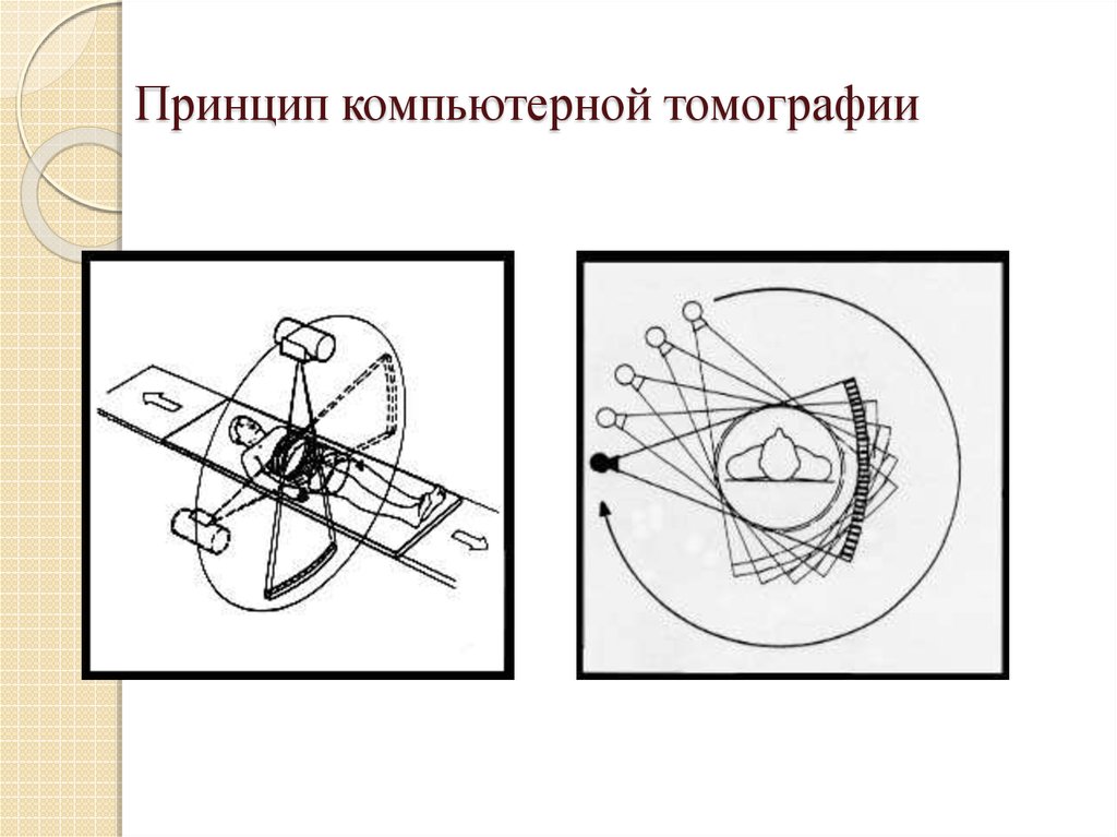 Схема компьютерная томография