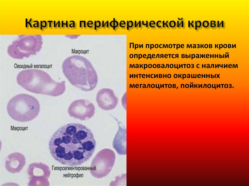 Состав периферической крови