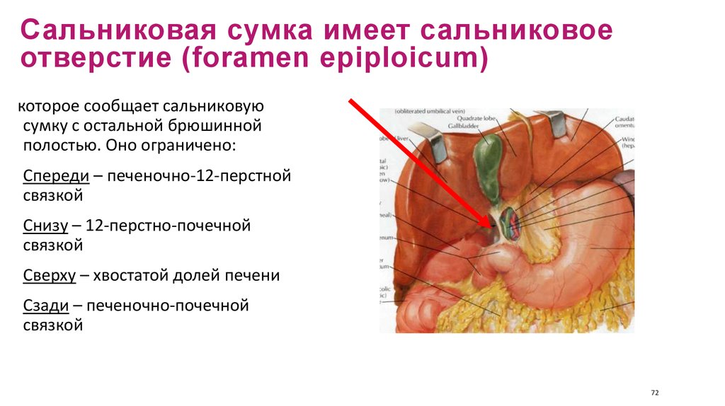 Печеночная сумка. Сальниковое винслово отверстие. Отверстие сальниковой сумки винслово отверстие. Сальниковое (Винслоево) отверстие. Отверстие сальниковой сумки винслово.