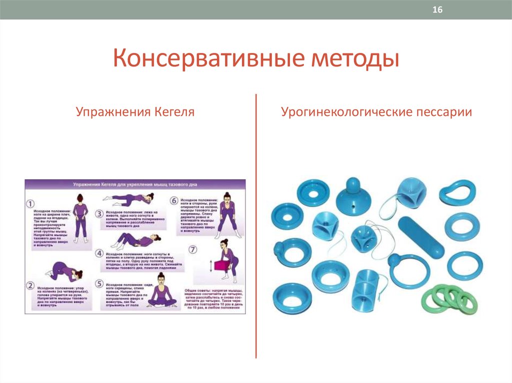 Операция пролапса органов малого таза. Консервативные методы лечения пролапса тазовых органов. Пролапс тазовых органов классификация. Классификация опущения тазовых органов. Факторы риска пролапса тазовых органов.