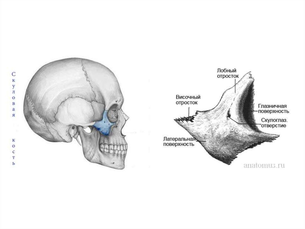 Верхняя скуловая кость. Лобный отросток верхней челюсти. Анатомия скуловой кости. Скуловой отросток височной кости. Скуловая кость анатомия строение.