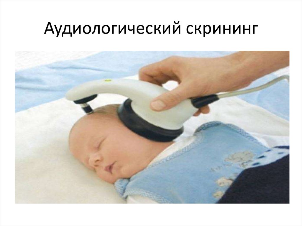 Как проверить слух у новорожденного. Аудиологический скрининг новорожденных аппарат. Прибор для проверки слуха у новорожденных. Аппарат для проверки слуха у новорожденных. Аппарат для аудиоскрининга новорожденных.