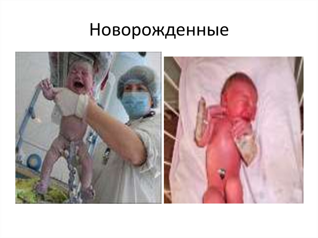 Новорожденные