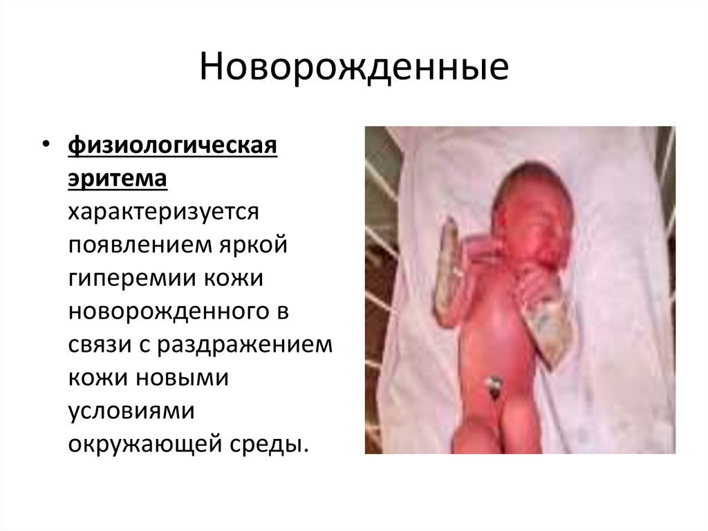 Новорожденные