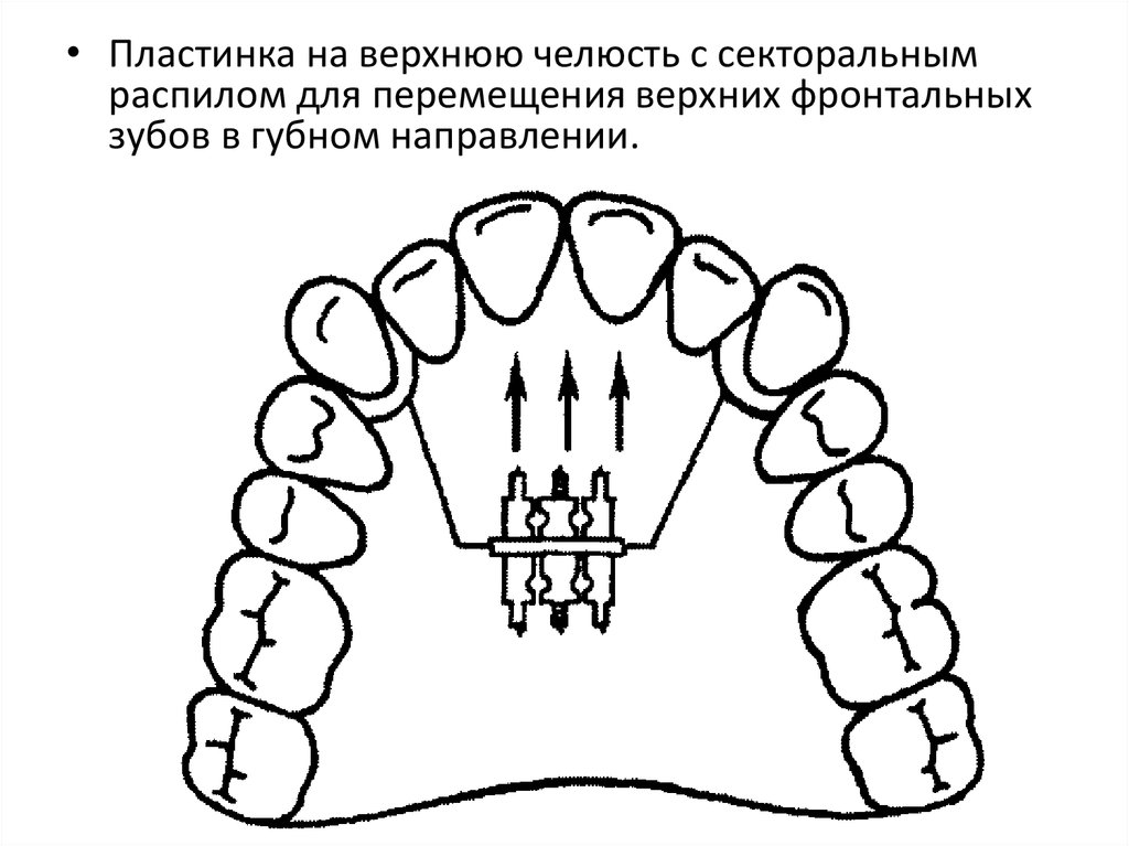 Фронтальная группа зубов рисунок