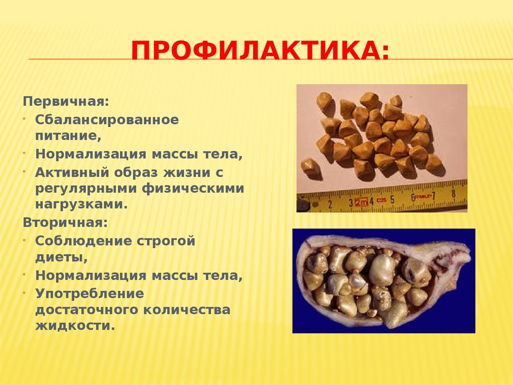 Профилактика: