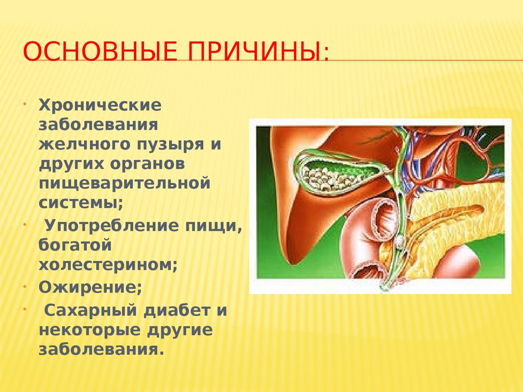 Основные причинЫ: