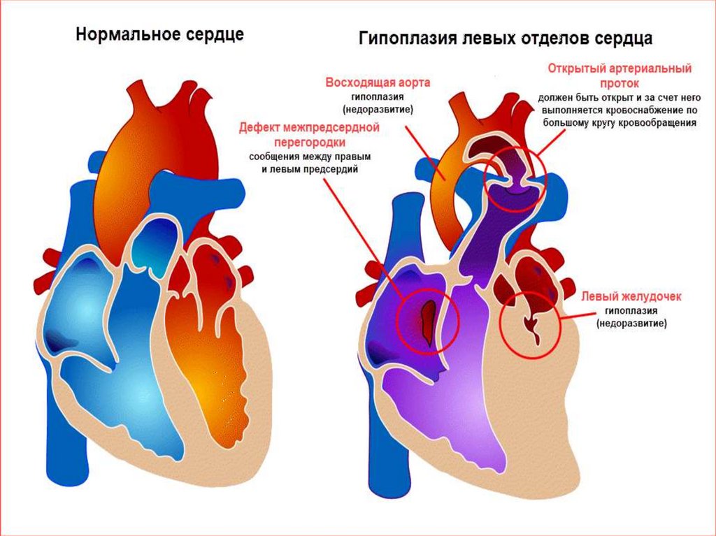 Отделы сердца