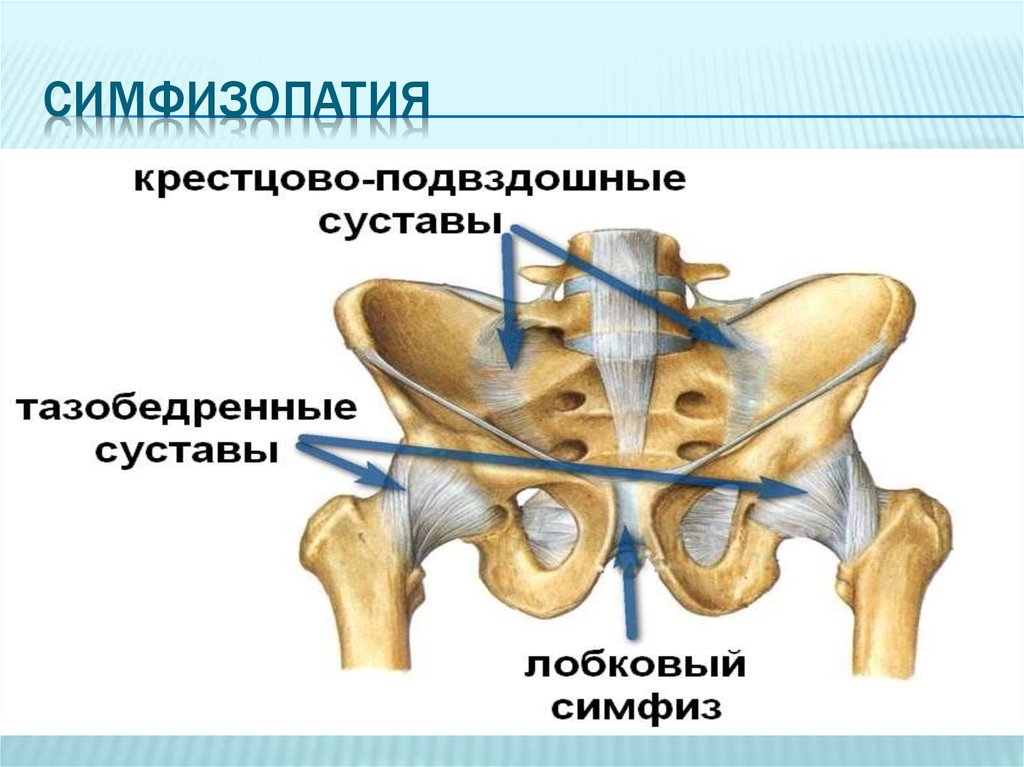 Соединение лобковых костей. Крестцово подвздошный сустав Тип сустава. Крестцово-подвздошный сустав функции. Кресцоподвздошрый сустав. Соединение крестцово подвздошного сустава.