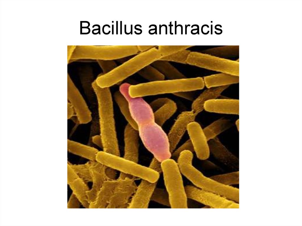 Бацилла это. Bacillus anthracis Сибирская язва. Bacillus anthracis препарат.