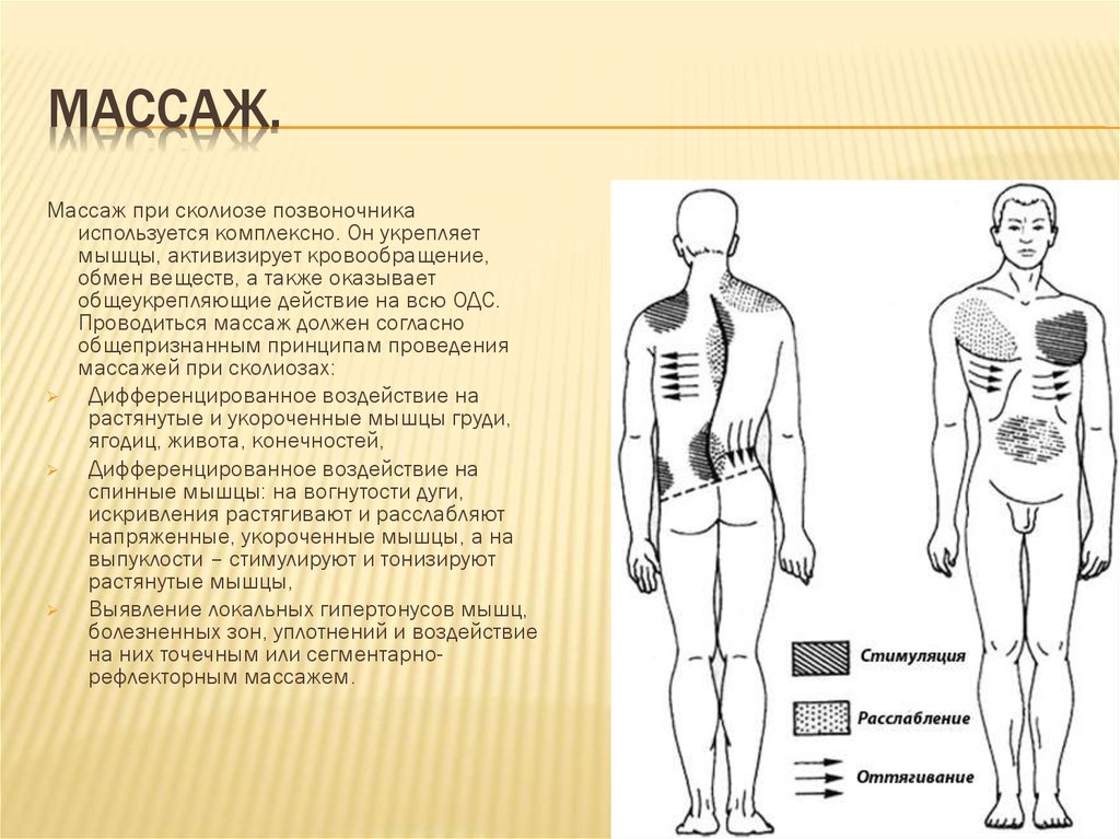 Массаж при сколиозе картинки