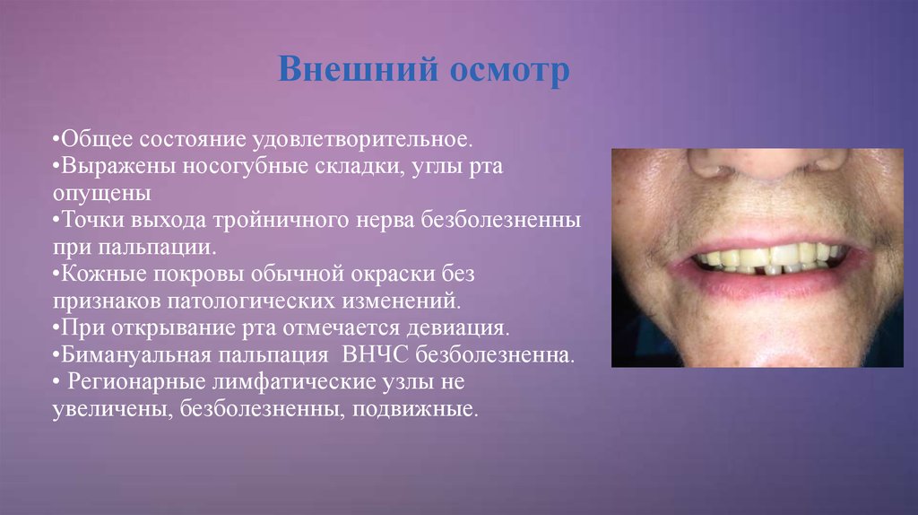 Без признаков. Кожные покровы обычной окраски. Девиация открывания рта. Общее состояние удовлетворительное, кожные.