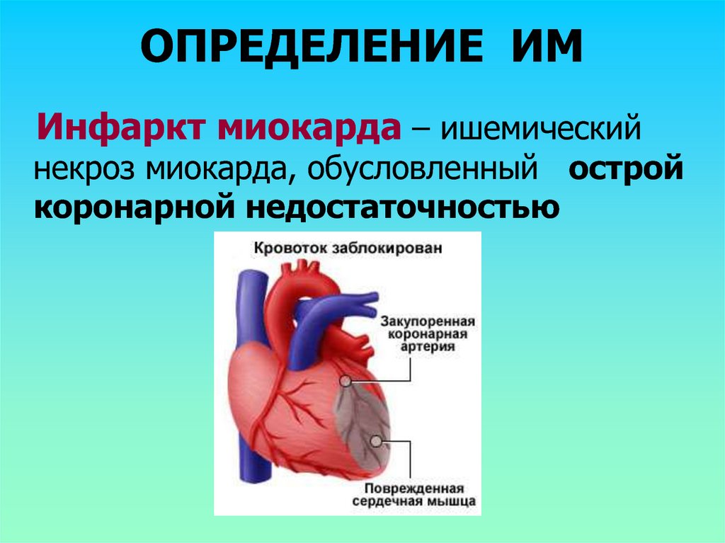 Оим это. Инфаркт миокарда определение. Инфаркт миокарда презентация. Острый инфаркт миокарда презентация.