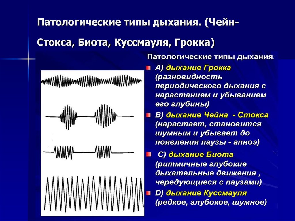 Шумы сердца пропедевтика презентация