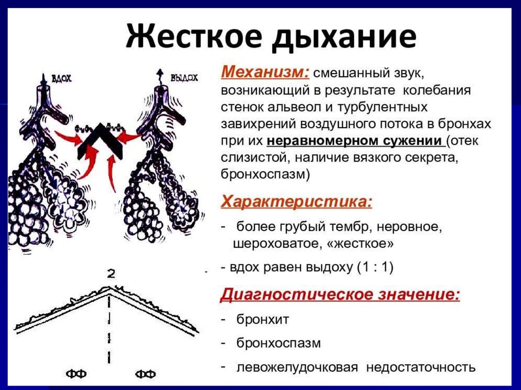 Кашель жесткое дыхание