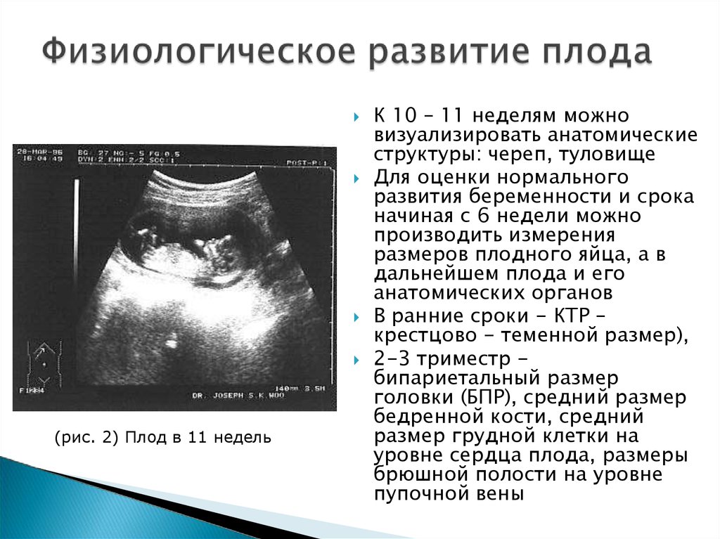 Срок 7 Недель Беременности Размер Плода Фото