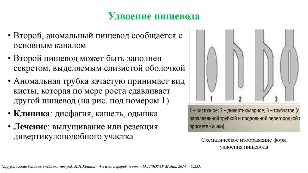 Травмы пищевода презентация