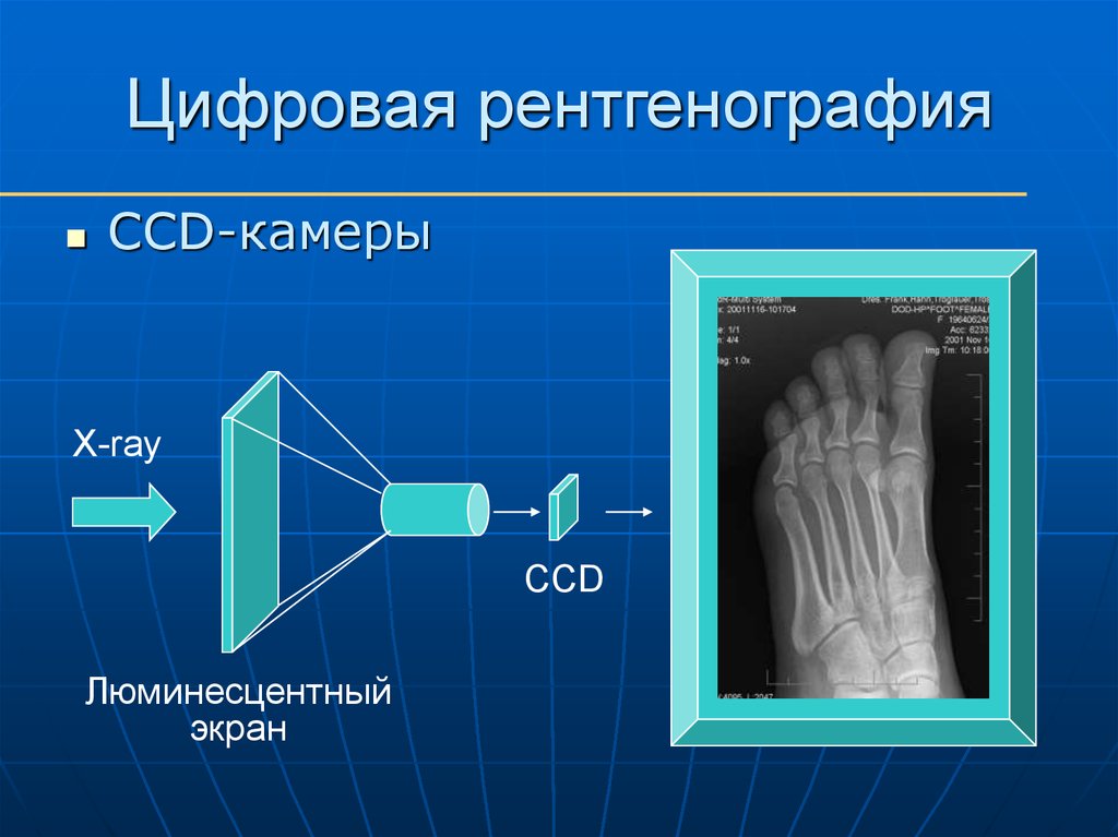 Рентгенография это. Цифровая рентгенография. Цифровое рентгеновское изображение. Цифровой рентген снимок. Аналоговый и цифровой рентген.