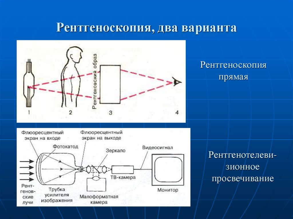 В чем смысл рентгенографии с прямым увеличением рентгеновского изображения