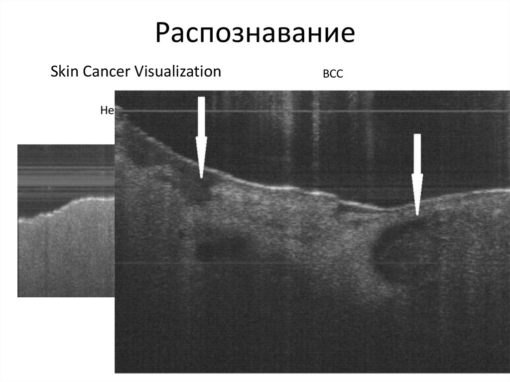 Распознавание