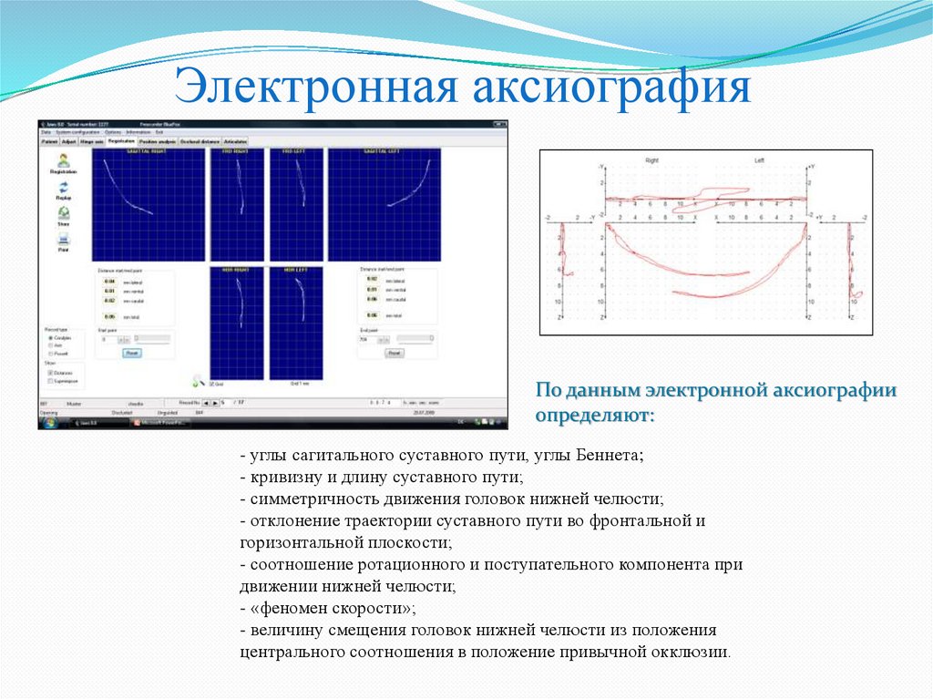 Аксиография в стоматологии презентация