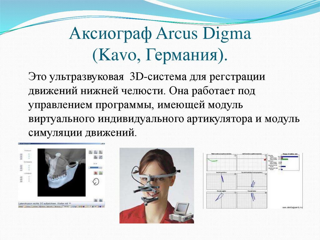 Эндосистемы в стоматологии презентация