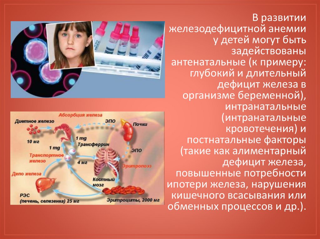 Факторы развития анемий. Факторы риска железодефицитной анемии. Факторы риска развития жда. Причины развития анемии. Факторы развития железодефицитной анемии.