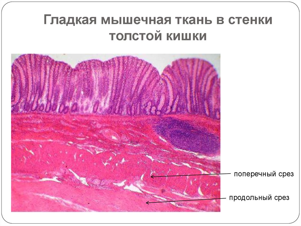 Ткани кишечника. Стенка толстой кишки гистология препарат. Гладкая мышечная ткань кишки гистология. Ткани тонкой кишки гистология. Срез стенки толстой кишки.