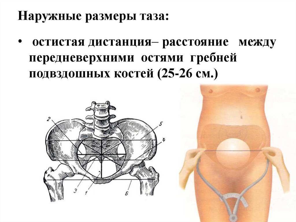 Размеры женского таза презентация