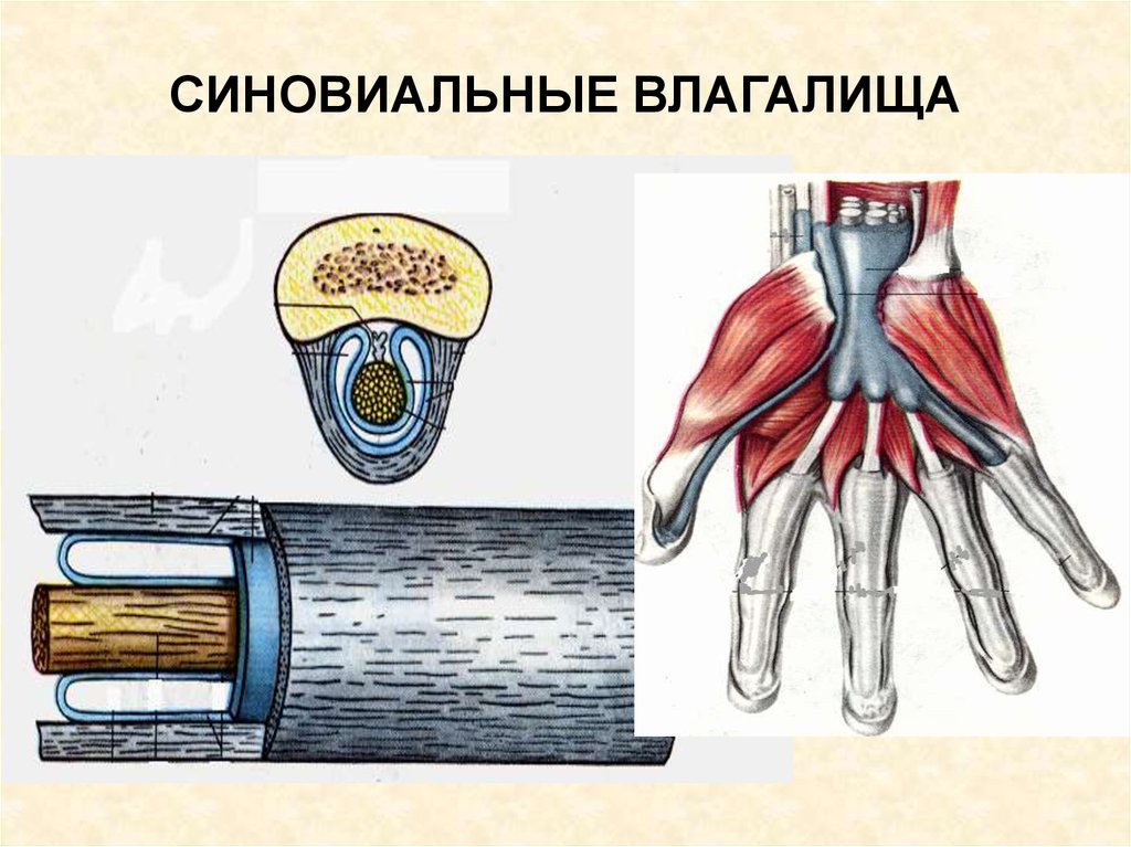 Что такое тендовагинит. Синовиальные влагалища сухожилий кисти. Синовиальные влагалища лучезапястного сустава. Синовиальные влагалища сухожилий сгибателей кисти. Синовиальные влагалища мышц сгибателей.