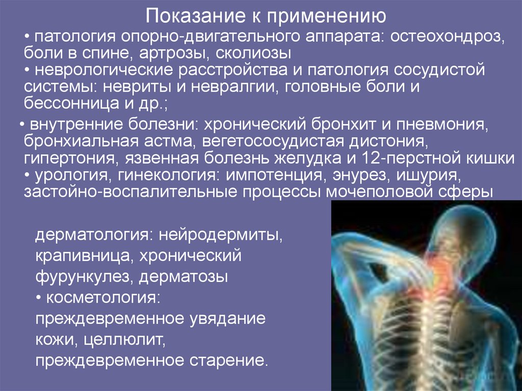 К нарушениям опорно двигательного аппарата относят. Патологии опорно-двигательного аппарата. Аномалии опорно-двигательного аппарата. Симптомы заболеваний опорно-двигательного аппарата. Заболевания опорно-двигательного аппарата остеохондроз.