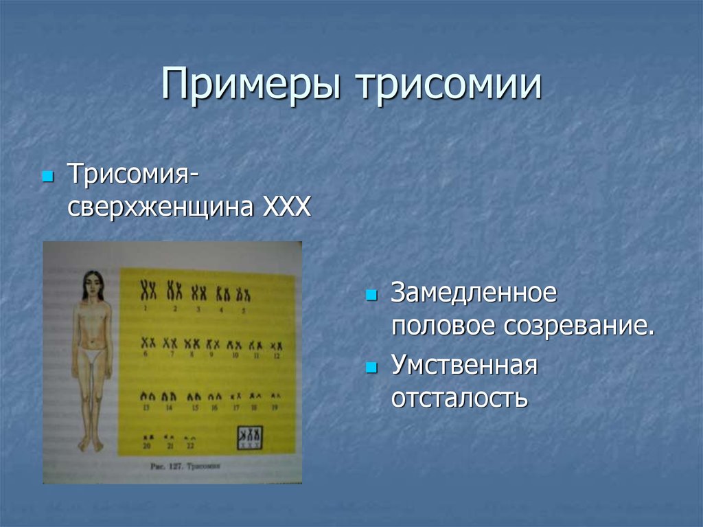 Трисомия это. Пример трисомии у человека примеры. Трисомия примеры болезней.