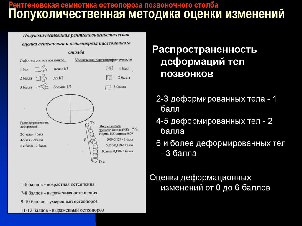 Рентген семиотика