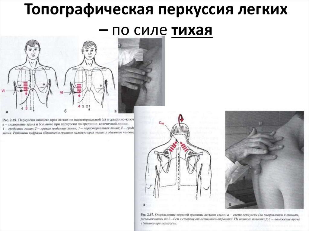 Перкуссия легких сравнительная и топографическая. Перкуссия грудной клетки алгоритм. Перкуссия грудной клетки в норме. Топографическая перкуссия грудной клетки. Перкуссия грудной клетки таблица.