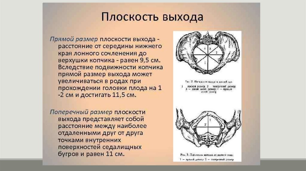 Вошел в малую. Прямой размер плоскости выхода малого таза. Прямой размер в малый таз. Поперечный размер входа в малый таз. Размеры плоскости входа в малый таз.