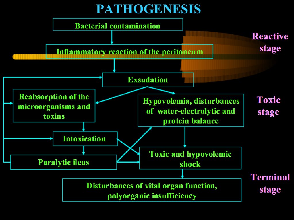 acute-peritonitis-online-presentation