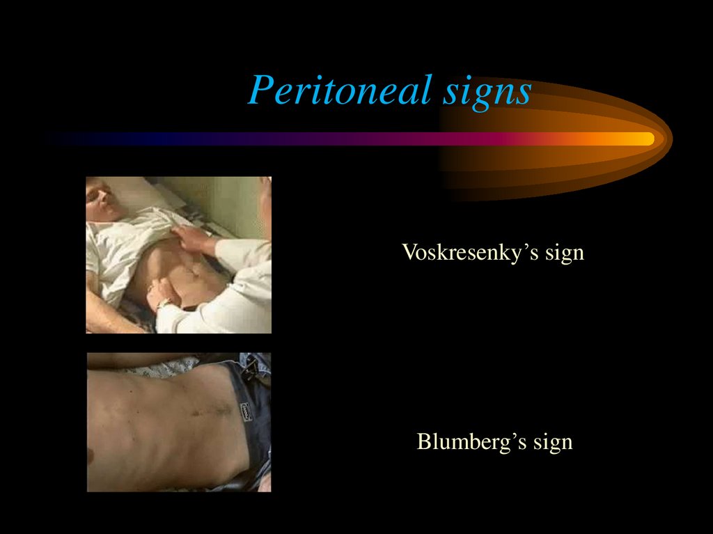 acute-peritonitis-online-presentation