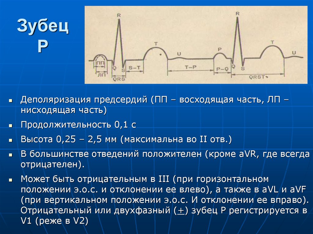 Что значит изменения зубца т. Отрицательный зубец р в 3 отведении на ЭКГ. Двухфазный зубец р на ЭКГ во 2 стандартном отведении. Отрицательная фаза зубца р. В нормальной ЭКГ зубец р в v1.