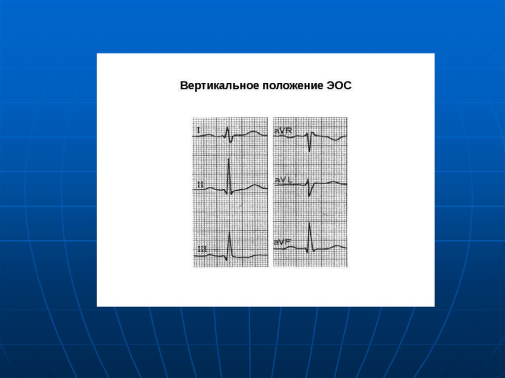 Основы экг презентация