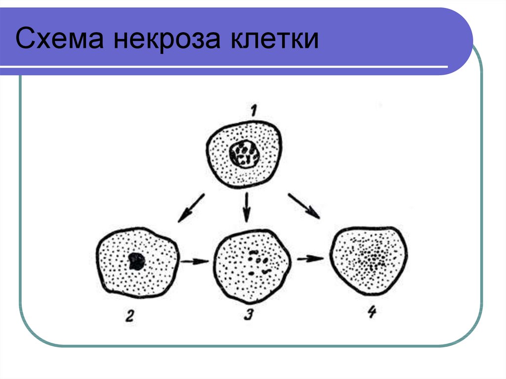 Исходы некроза схема