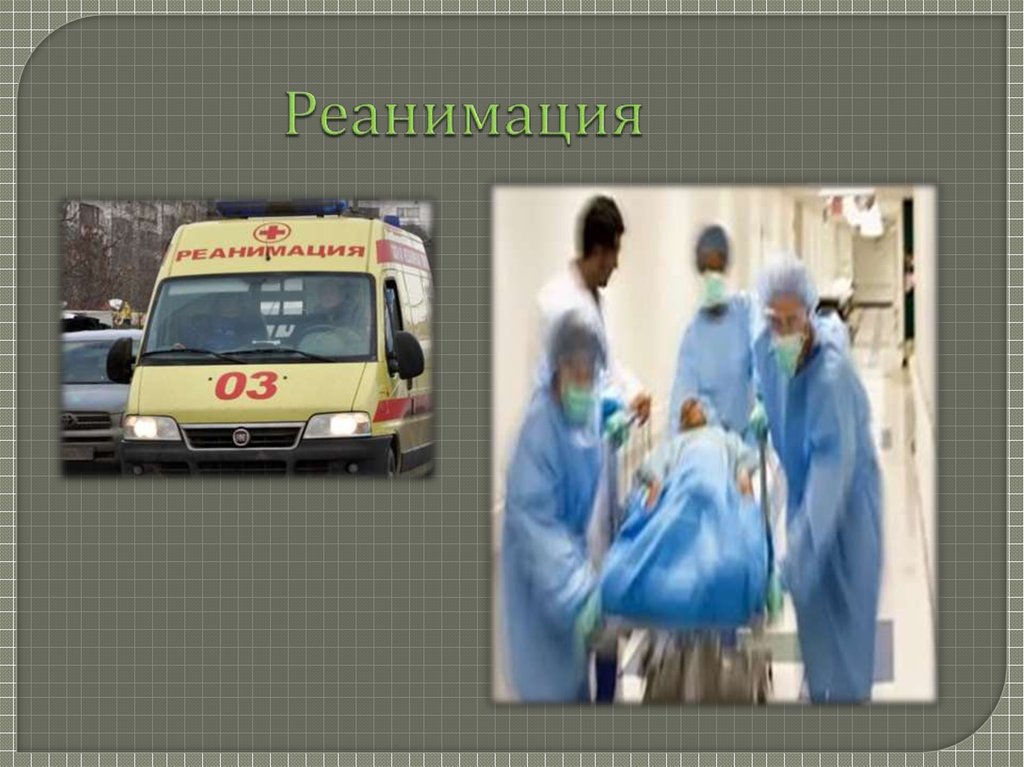 Реанимация