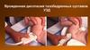 Врожденная дисплазия тазобедренных суставов УЗД