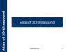 Atlas of 3D Ultrasound