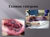 Газовая гангрена