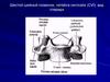 Шестой шейный позвонок, vertebra cervicalis (CVI); вид спереди