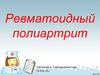 Ревматоидный полиартрит