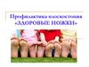 Профилактика плоскостопия