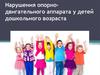 Нарушения опорно-двигательного аппарата у детей дошкольного возраста